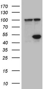 HDAC8 Antibody in Western Blot (WB)