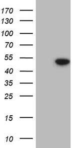 HDAC8 Antibody in Western Blot (WB)