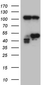 HDAC8 Antibody in Western Blot (WB)