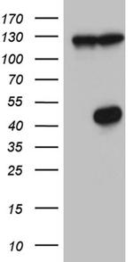 HDAC8 Antibody in Western Blot (WB)