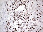 HDAC9 Antibody in Immunohistochemistry (Paraffin) (IHC (P))