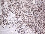 HDAC9 Antibody in Immunohistochemistry (Paraffin) (IHC (P))