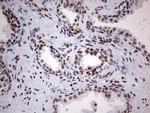 HDAC9 Antibody in Immunohistochemistry (Paraffin) (IHC (P))