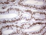 HDAC9 Antibody in Immunohistochemistry (Paraffin) (IHC (P))