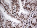 HDAC9 Antibody in Immunohistochemistry (Paraffin) (IHC (P))