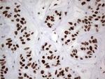 HDAC9 Antibody in Immunohistochemistry (Paraffin) (IHC (P))