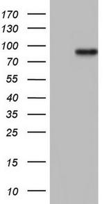 HDAC9 Antibody in Western Blot (WB)