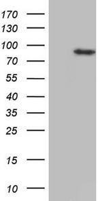 HDAC9 Antibody in Western Blot (WB)