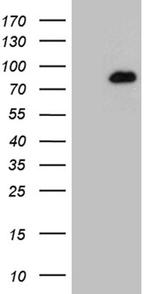 HDAC9 Antibody in Western Blot (WB)