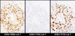 HDGF Antibody in Immunohistochemistry (IHC)