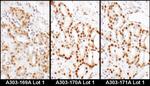 HDGF Antibody in Immunohistochemistry (IHC)