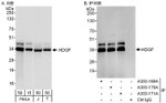 HDGF Antibody in Western Blot (WB)