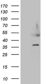 HDGF Antibody in Western Blot (WB)