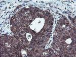 HDHD1 Antibody in Immunohistochemistry (Paraffin) (IHC (P))