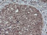 HDHD1 Antibody in Immunohistochemistry (Paraffin) (IHC (P))