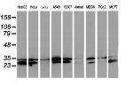 HDHD1 Antibody in Western Blot (WB)