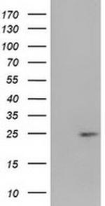 HDHD1 Antibody in Western Blot (WB)