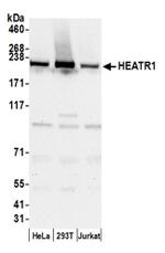 HEATR1/BAP28 Antibody in Western Blot (WB)