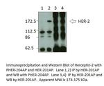 ErbB 2 Antibody in Western Blot (WB)