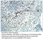 ErbB 4 Antibody in Immunohistochemistry (IHC)