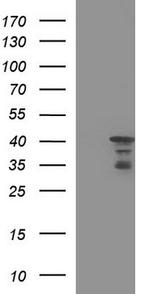 HERPUD1 Antibody in Western Blot (WB)