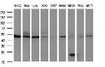 HERPUD1 Antibody in Western Blot (WB)