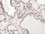 HES1 Antibody in Immunohistochemistry (Paraffin) (IHC (P))