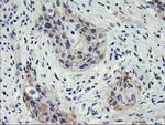 HES1 Antibody in Immunohistochemistry (Paraffin) (IHC (P))