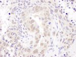 HEXIM1 Antibody in Immunohistochemistry (IHC)