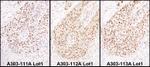 HEXIM1 Antibody in Immunohistochemistry (IHC)