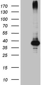 HFE2 Antibody in Western Blot (WB)