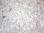 HGF Antibody in Immunohistochemistry (Paraffin) (IHC (P))