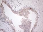 HGF Antibody in Immunohistochemistry (Paraffin) (IHC (P))