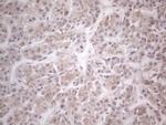 HGF Antibody in Immunohistochemistry (Paraffin) (IHC (P))