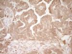 HGF Antibody in Immunohistochemistry (Paraffin) (IHC (P))