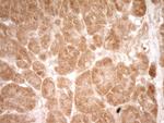 HGF Antibody in Immunohistochemistry (Paraffin) (IHC (P))