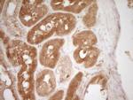 HGF Antibody in Immunohistochemistry (Paraffin) (IHC (P))