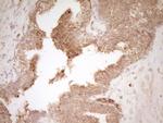 HGF Antibody in Immunohistochemistry (Paraffin) (IHC (P))