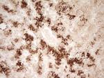 HGF Antibody in Immunohistochemistry (Paraffin) (IHC (P))