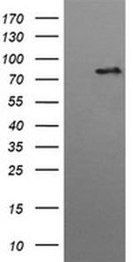 HGS Antibody in Western Blot (WB)