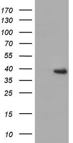 HIBCH Antibody in Western Blot (WB)