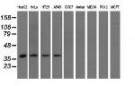 HIBCH Antibody in Western Blot (WB)