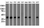 HIBCH Antibody in Western Blot (WB)