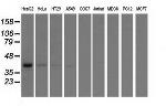 HIBCH Antibody in Western Blot (WB)