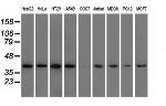 HIBCH Antibody in Western Blot (WB)