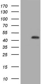 HIBCH Antibody in Western Blot (WB)