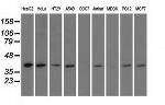 HIBCH Antibody in Western Blot (WB)