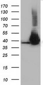 HIBCH Antibody in Western Blot (WB)