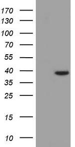 HIBCH Antibody in Western Blot (WB)