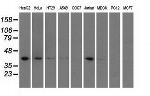 HIBCH Antibody in Western Blot (WB)